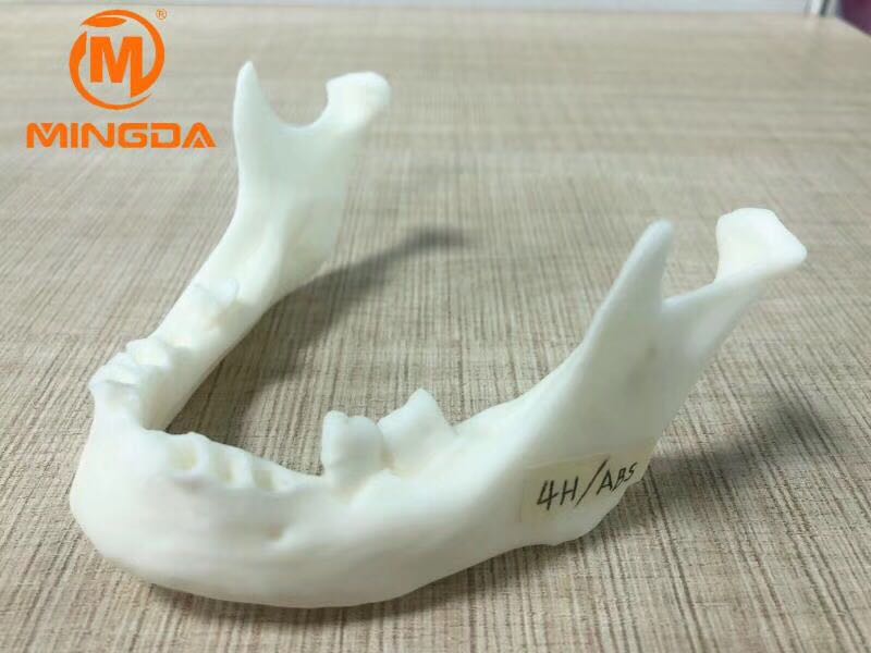 工業(yè)級3D打印機在牙科行業(yè)的應(yīng)用(圖1)